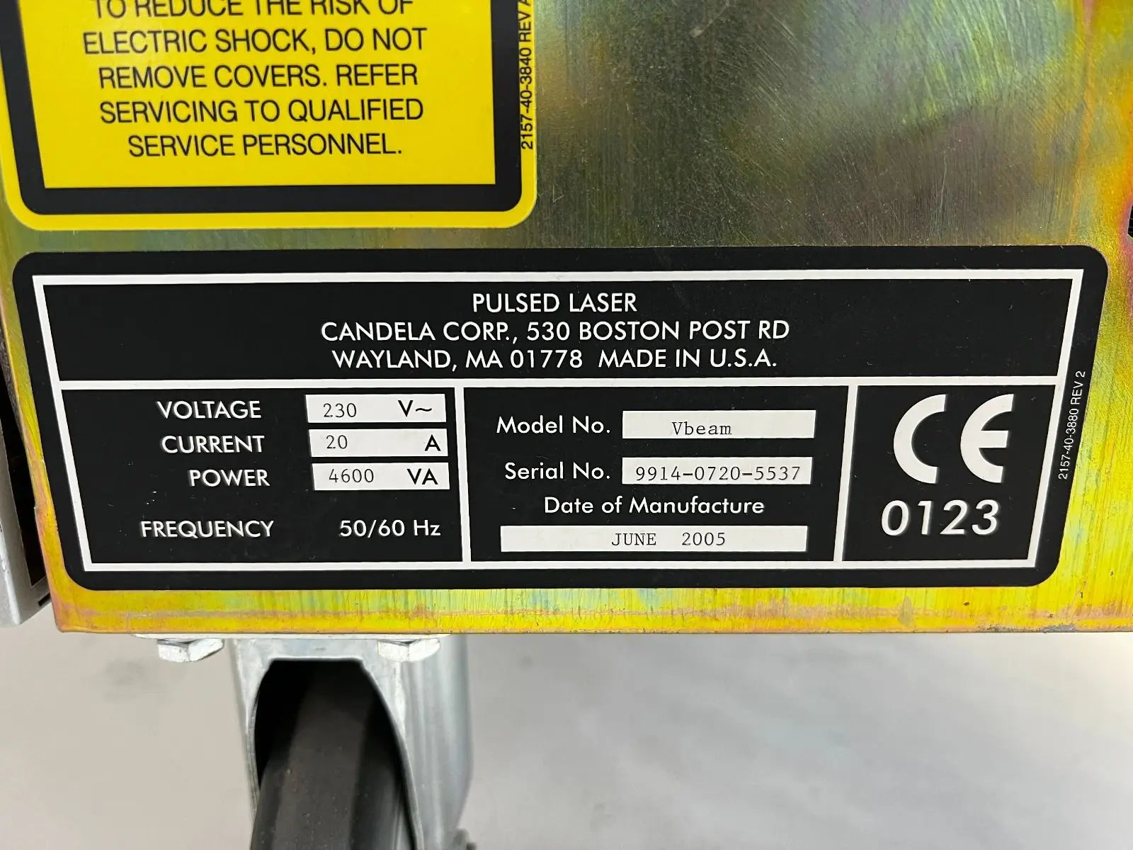 2005 Candela V-Beam PDL Pulsed Dye Laser Pulse VBeam Lesions Vascular AS IS Candela