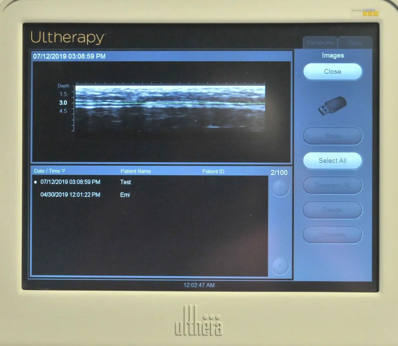 2013 Ulthera Ultherapy DEEPsee Ultrasound Skin Tightening Contouring + Handpiece Sol International Medical