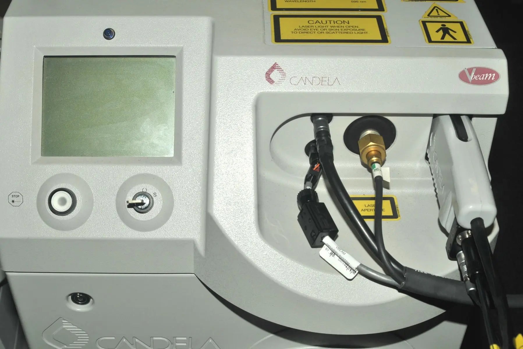 2005 Candela VBeam Wrinkles Scars Acne Stretch Marks Pulsed Dye Laser System Candela