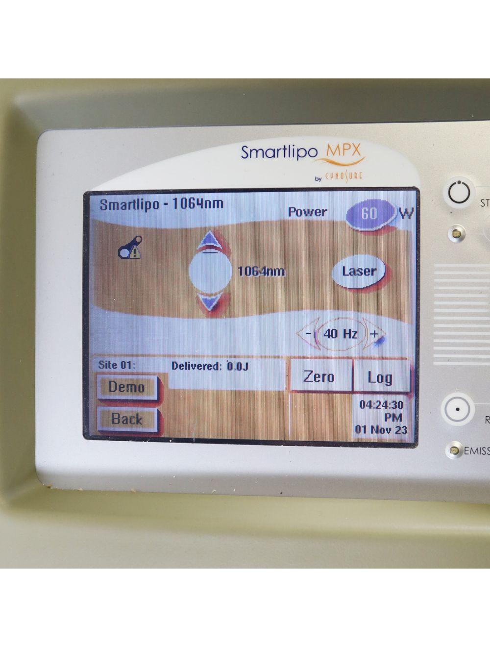 2008 Cynosure Smartlipo MPX 1064 1320 Nd YAG Laser BodySculpt Dual Wavelength Palomar