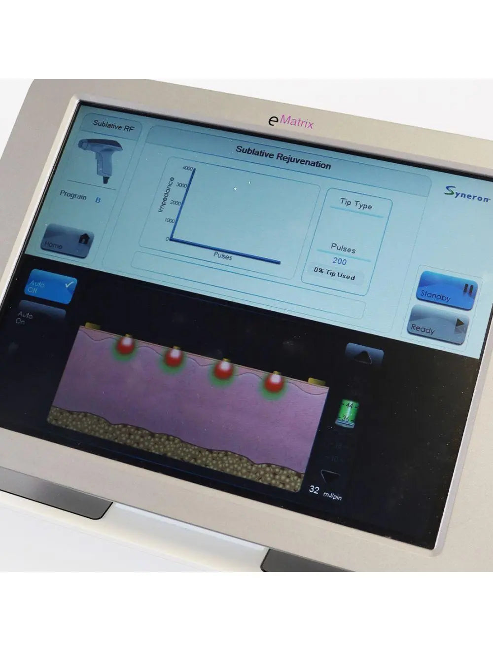 Syneron eMatrix Skin Rejuvenation TableTop Sublative RF System FG70442 Candela
