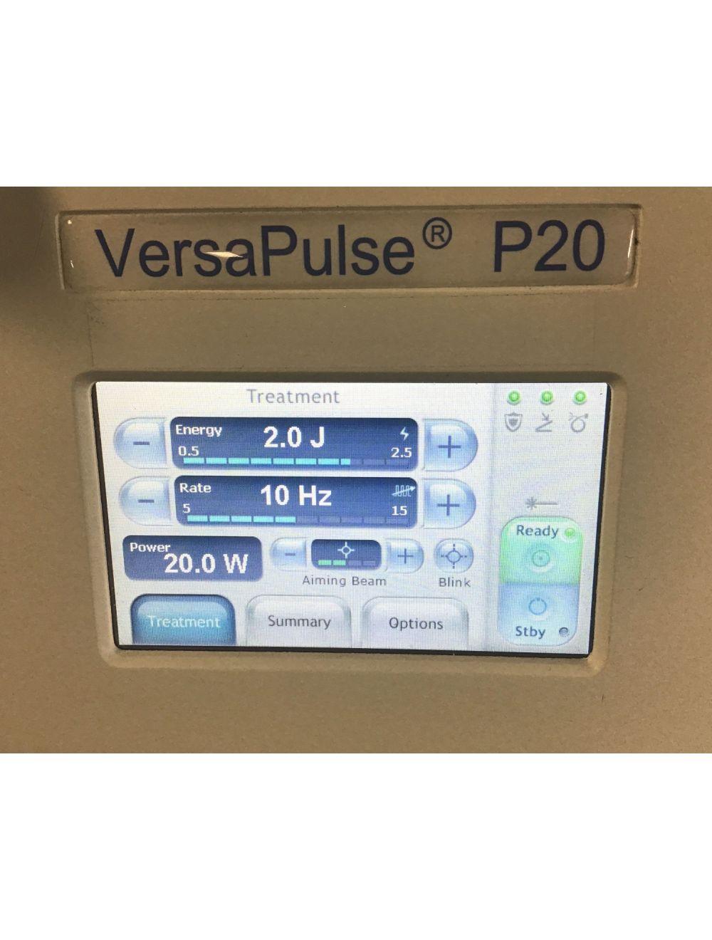 2014 Lumenis VERSAPULSE Holmium P20 YAG PowerSuite Laser Ablative ENT Stones Lumenis
