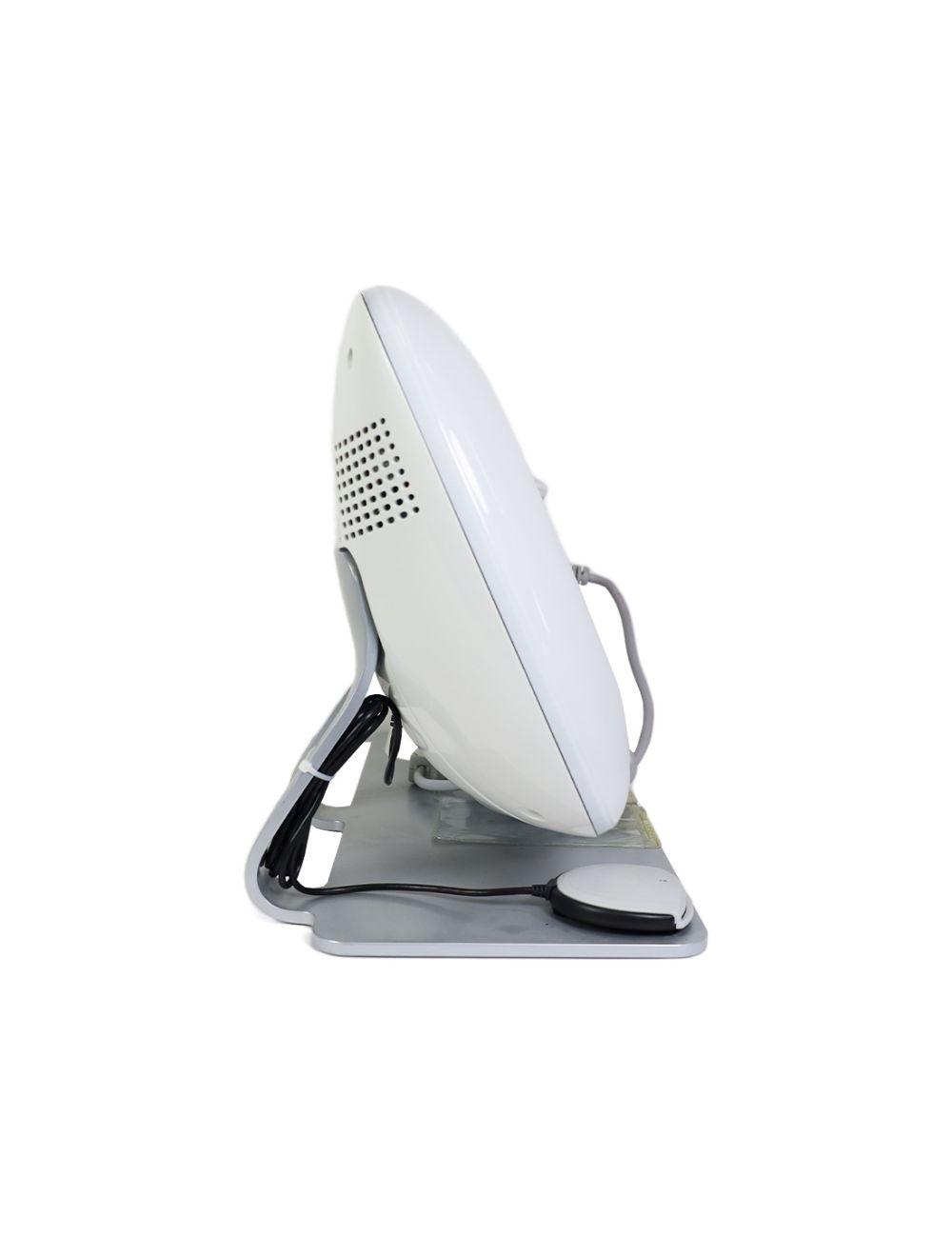 Solta Clear Brilliant Fractional Skin Resurfacing Laser w/Handpiece CB-CONSOLE Solta Medical