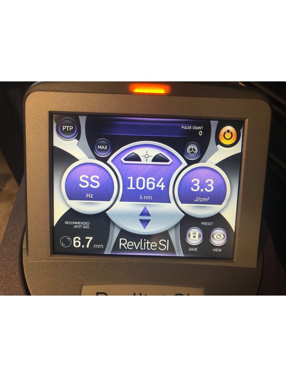 2021 Cynosure RevLite SI Q-Switched Laser System 532nm 1064nm Tattoo Removal Cynosure