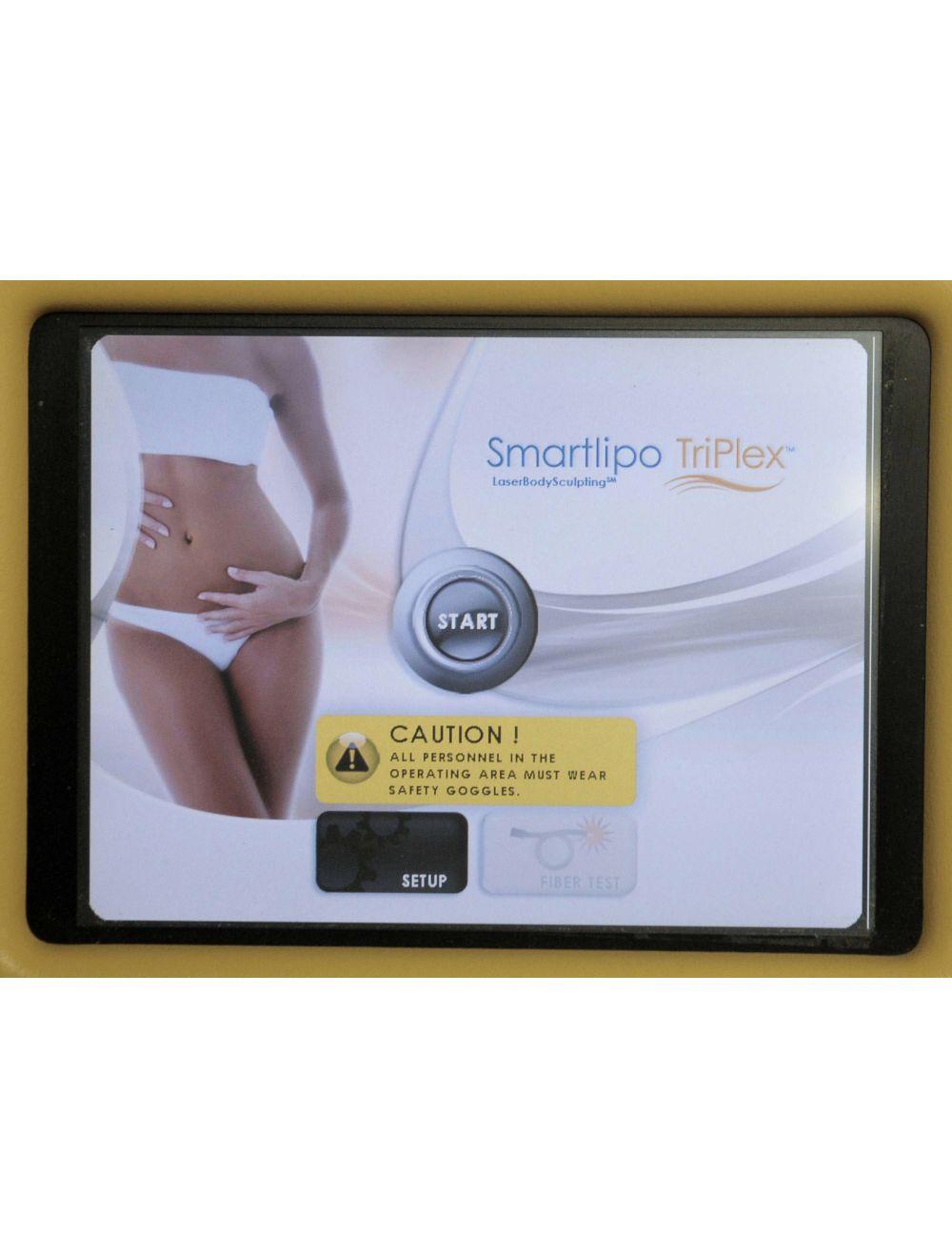 2011 SmartLipo SLT II Cynosure Triplex Cellulaze Palomar Laser Neck Body Nd:YAG Palomar