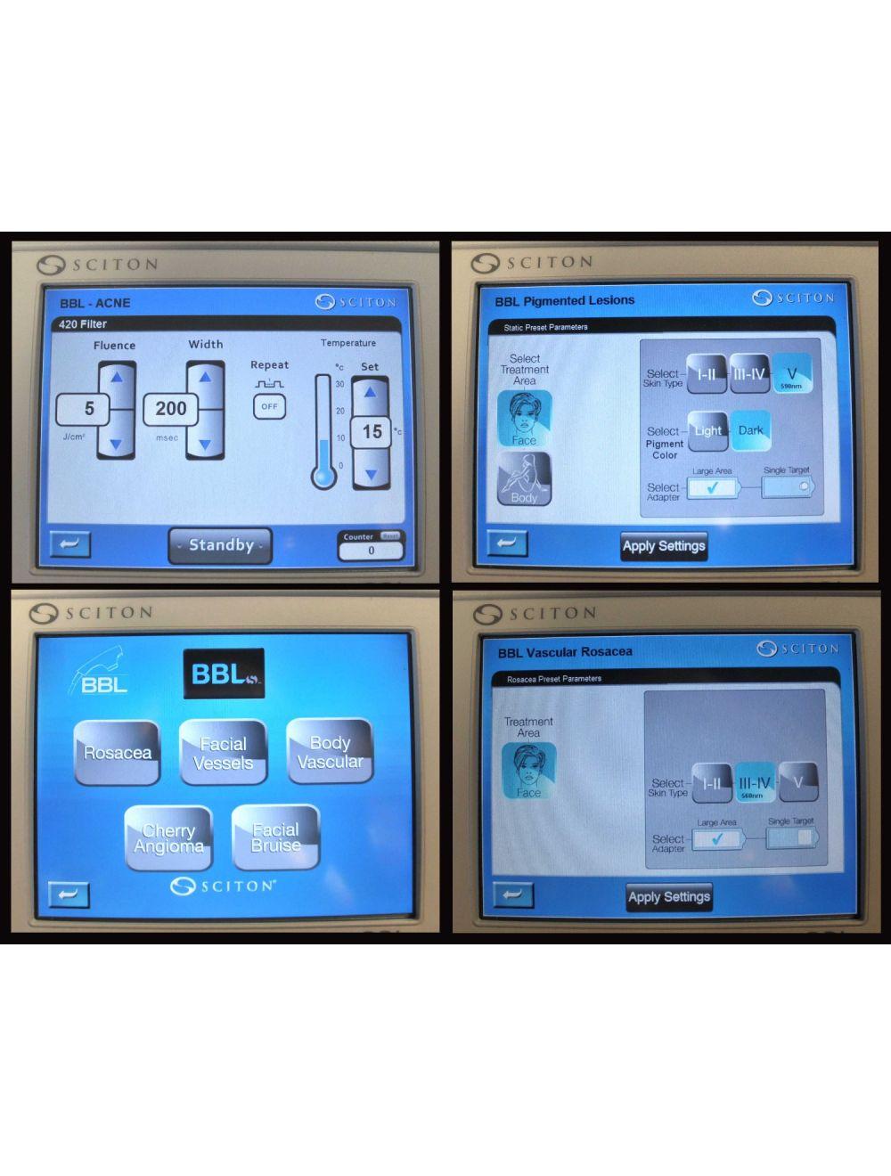 Sciton Profile BBLs Laser Broad Band Light Pigment Hair Removal Vascular Loaded Sol International Medical