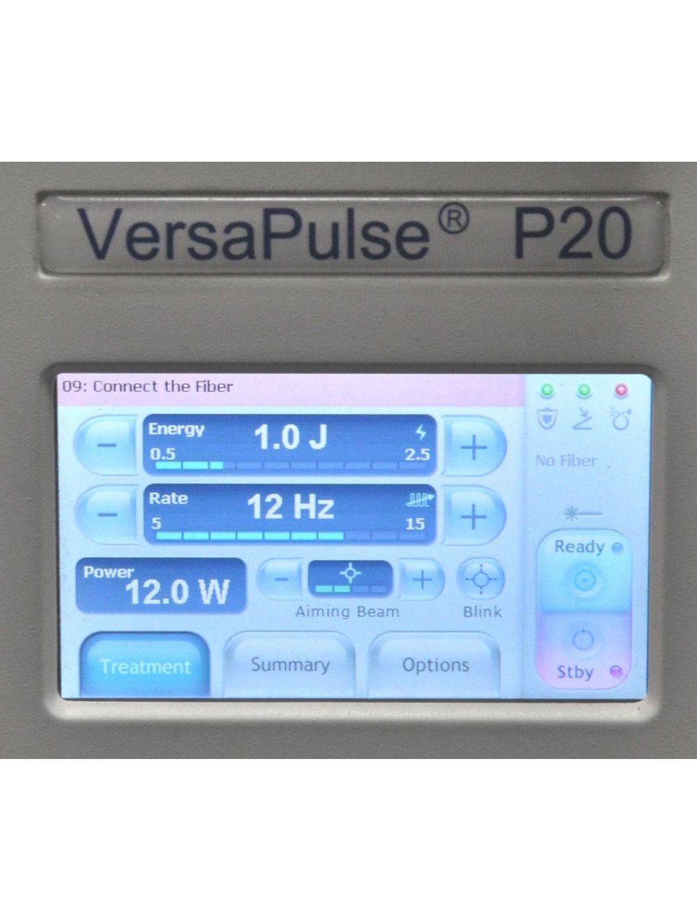 2015 Lumenis Versapulse P20 Holmium PowerSuite YAG Stones ENT Compact Laser Lumenis