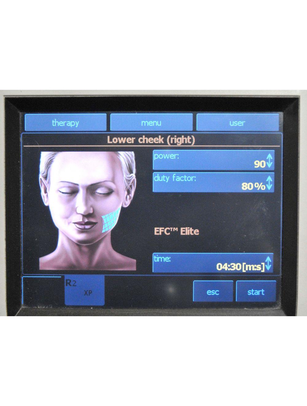 2011 BTL Exilis Elite RF Radio Frequency 90 WATT Laser Contour Skin Tightening BTL
