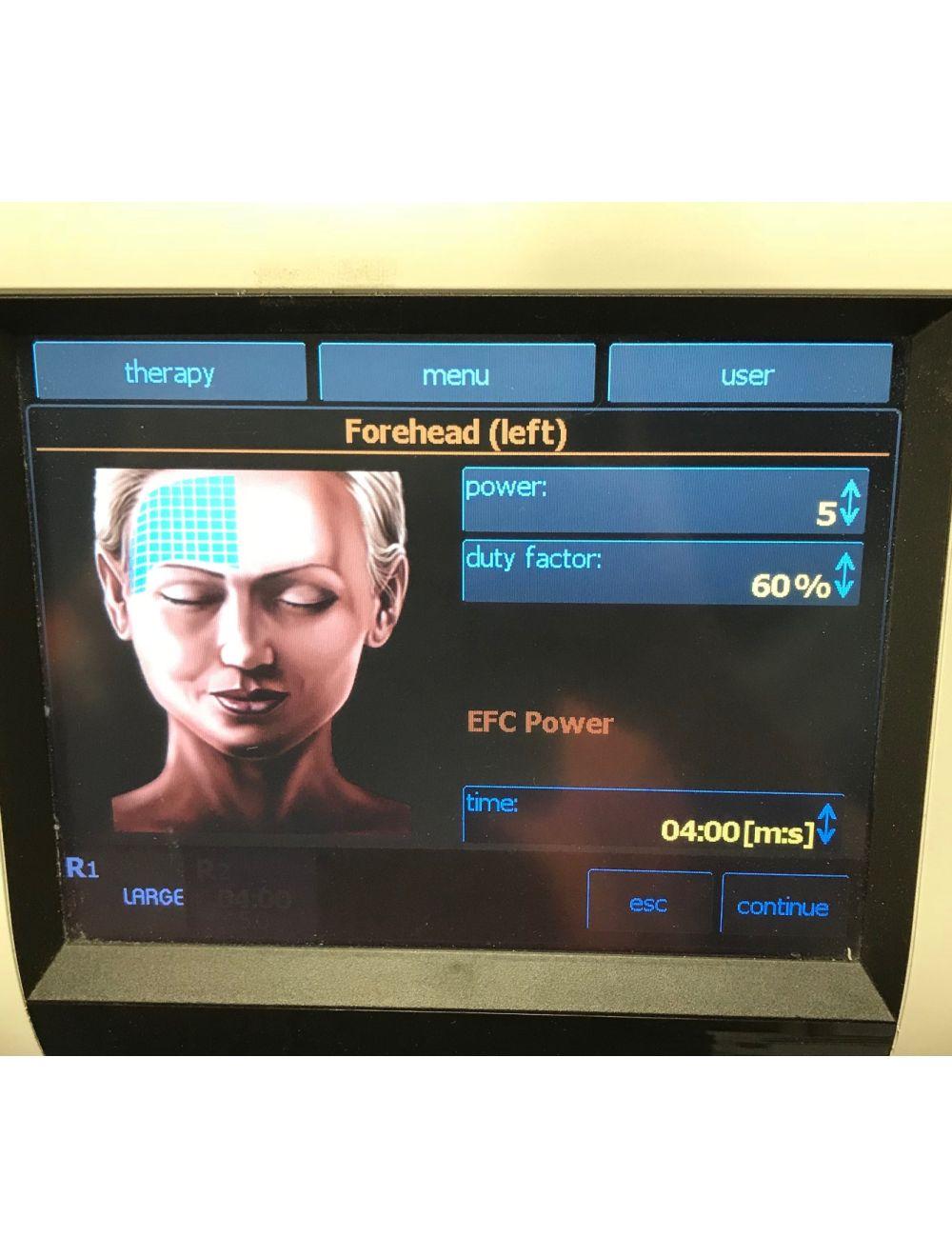 2011 BTL Exilis ELITE RF Radio Frequency 90 Watt Laser Fat Reduction BTL