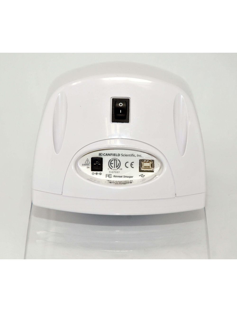CANFIELD Reveal Imager Facial Imaging System Skin Treatment Photos Hi Res Image Sol International Medical