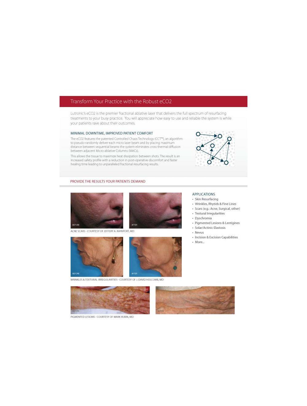 2008 Lutronic Surgical CO2 Laser eC02 Mosaic Skin Fractional Wrinkle Scar Lesion Lutronic