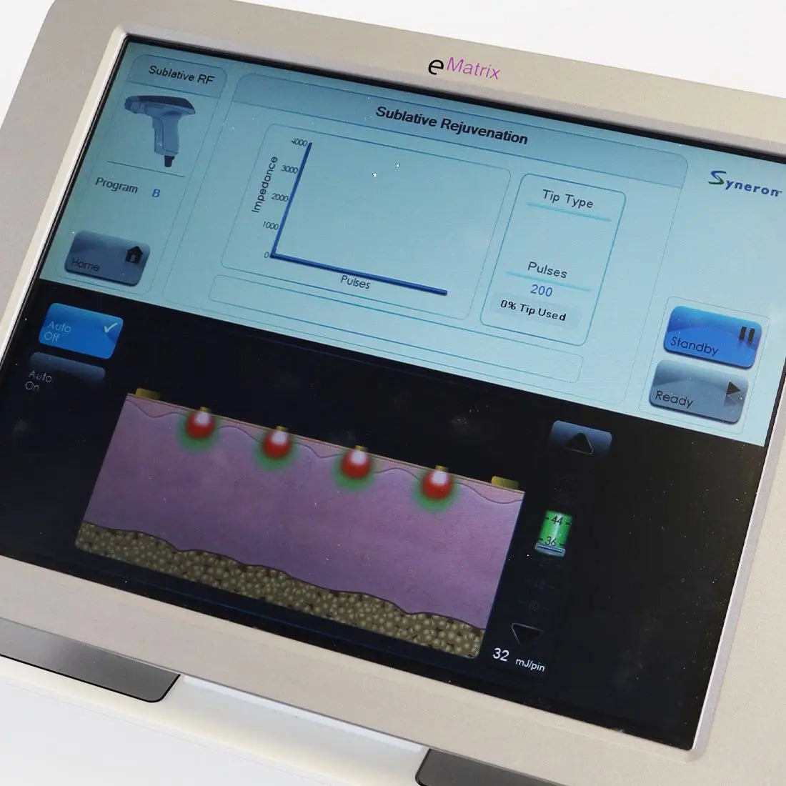 Syneron eMatrix Skin Rejuvenation TableTop Sublative RF System FG70442 Candela